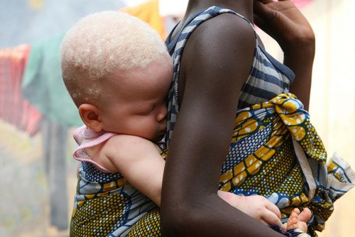Люди и животные с необычной внешностью  - albinosi.jpg