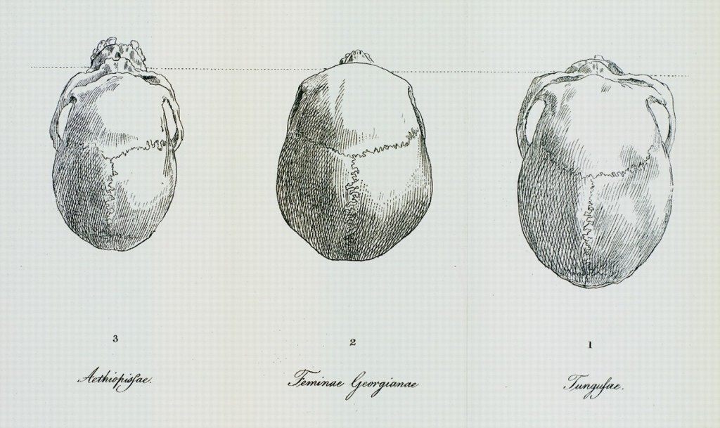 Грузины - самая красивая раса людей Blumenbach  - Blumenbach_beautiful_Georgian_skull.jpg